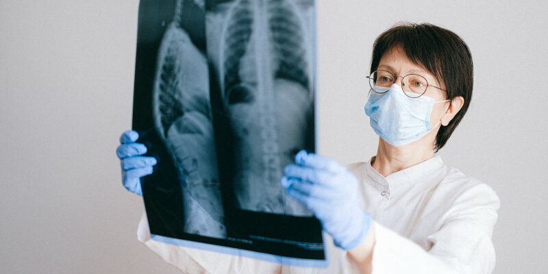 Was Betroffene bei Long-COVID tun können